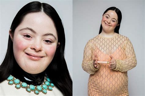 gucci new model down syndrome|gucci modeling.